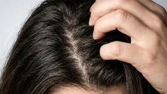 脂性頭皮で夕方に根元がテカる人へ、洗い方と皮脂ケアを見直す10のコツ